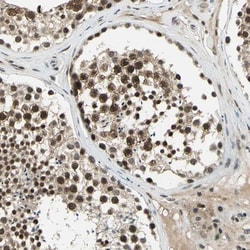 Rad17 Antibody, Novus Biologicals:Antibodies:Primary Antibodies