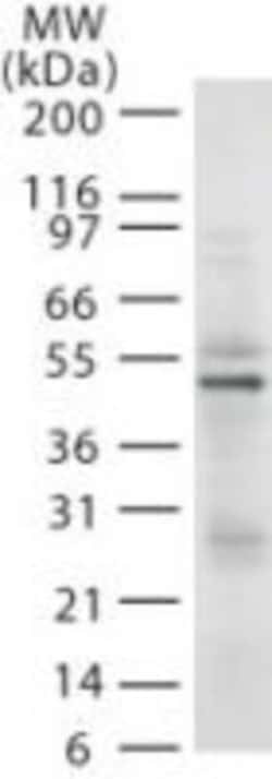 RAD18 Antibody (79B1048.1), Novus Biologicals 0.025mg; Unlabeled:Antibodies,