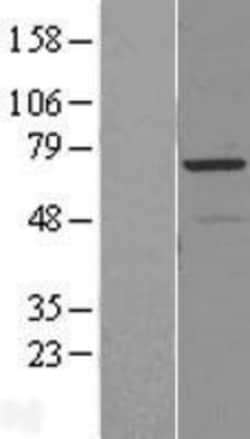 Novus Biologicals&trade;&nbsp;RAD18 Overexpression Lysate