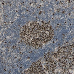 RAD18 Antibody, Novus Biologicals 0.1mL; Unlabeled:Antibodies, Polyclonal
