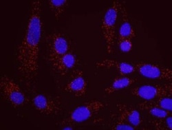 RAD18 Antibody, Novus Biologicals 0.1mL; Unlabeled:Antibodies, Polyclonal