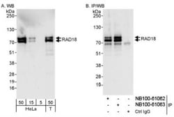 RAD18 Antibody, Novus Biologicals 0.1mL; Unlabeled:Antibodies, Polyclonal