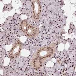 Rad23 Antibody, Novus Biologicals 25 &mu;L, Unlabeled:Antibodies, Polyclonal