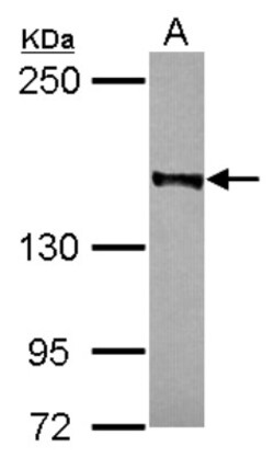 Rad50 Antibody, Novus Biologicals 0.1mL; Unlabeled:Antibodies, Polyclonal