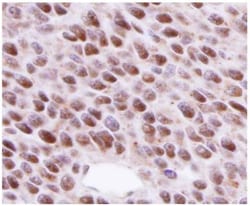 Rad51 Antibody (14B4), Novus Biologicals 0.1mg; Unlabeled:Antibodies, Monoclonal