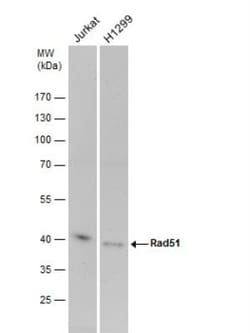 Rad51 Antibody (14B4), Novus Biologicals 0.1mg; Unlabeled:Antibodies, Monoclonal