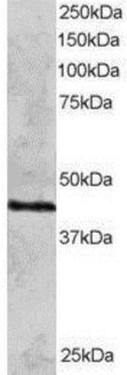 Rad51C Antibody, Novus Biologicals 0.1mg; Unlabeled:Antibodies, Polyclonal