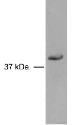 Rad51D Antibody (5B3/6), Novus Biologicals:Antibodies:Primary Antibodies