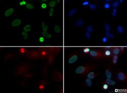 Rad51D Antibody (5B3/6), Novus Biologicals:Antibodies:Primary Antibodies