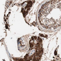 RAD54B Antibody, Novus Biologicals 25 &mu;L; Unlabeled:Antibodies, Polyclonal