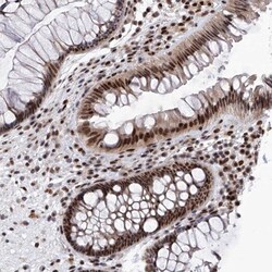 RAD54L Antibody, Novus Biologicals 0.1mL; Unlabeled:Antibodies, Polyclonal