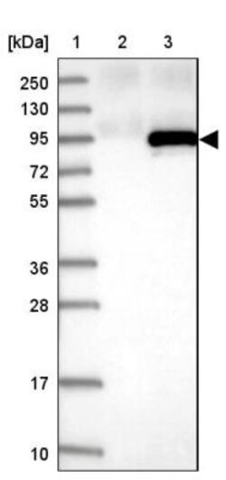 RAD54L Antibody, Novus Biologicals 0.1mL; Unlabeled:Antibodies, Polyclonal