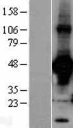 Novus Biologicals&trade;&nbsp;Rad9 Overexpression Lysate