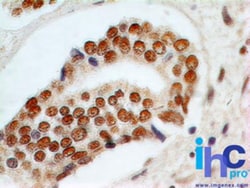Rad9 Antibody (93A535) - BSA Free, Novus Biologicals:Antibodies:Primary