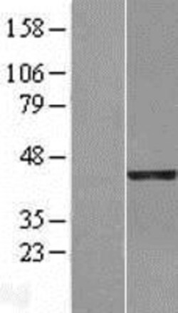 Novus Biologicals™ RAE1 Overexpression Lysate