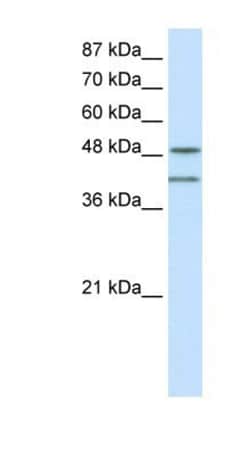 RAE1 Antibody, Novus Biologicals 100&mu;L; Unlabeled:Antibodies, Polyclonal
