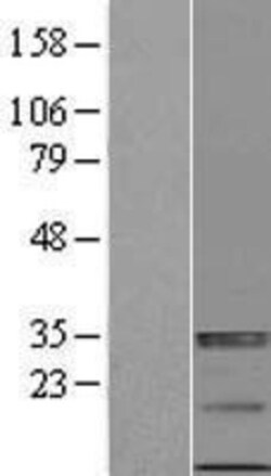 Novus Biologicals™ ULBP-4/RAET1E Overexpression Lysate