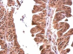 MOK Antibody, Novus Biologicals 0.1 mL | Buy Online | Novus Biologicals | Fisher Scientific