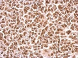 MOK Antibody, Novus Biologicals 0.1 mL | Buy Online | Novus Biologicals | Fisher Scientific