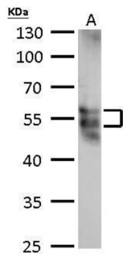 MOK Antibody, Novus Biologicals 0.1 mL | Buy Online | Novus Biologicals | Fisher Scientific