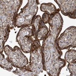 RAI14 Antibody, Novus Biologicals 0.1mL; Unlabeled:Antibodies, Polyclonal