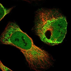 RAI16 Antibody, Novus Biologicals 25 &mu;L, Unconjugated:Antibodies, Polyclonal