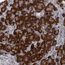 RAI16 Antibody, Novus Biologicals 25 &mu;L, Unconjugated:Antibodies, Polyclonal