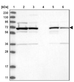 RAI16 Antibody, Novus Biologicals 25 &mu;L, Unconjugated:Antibodies, Polyclonal