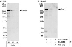 RAI1 Antibody, Novus Biologicals 0.1mg; Unlabeled:Antibodies, Polyclonal