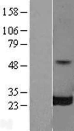 Novus Biologicals&trade;&nbsp;RalB Overexpression Lysate