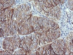 RalB Antibody (OTI2C4), Novus Biologicals 0.1mL; Unlabeled:Antibodies,