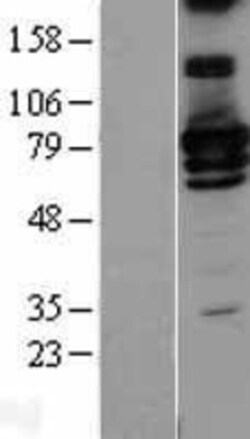 Novus Biologicals&trade;&nbsp;RALBP1 Overexpression Lysate