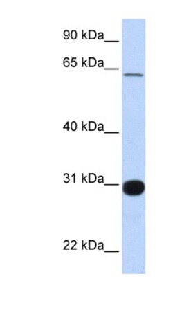 RALGPS1 Antibody, Novus Biologicals 100&mu;L; Unlabeled:Antibodies, Polyclonal