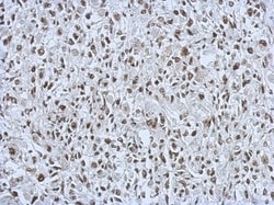 RALY Antibody, Novus Biologicals 0.1mL; Unlabeled:Antibodies, Polyclonal