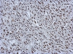 RALY Antibody, Novus Biologicals 0.1mL; Unlabeled:Antibodies, Polyclonal