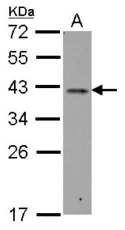 RALY Antibody, Novus Biologicals 0.1mL; Unlabeled:Antibodies, Polyclonal