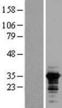 Novus Biologicals&trade;&nbsp;RALY Overexpression Lysate