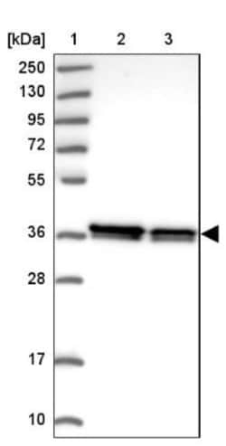 RALY Antibody, Novus Biologicals 25 &mu;L, Unlabeled:Antibodies, Polyclonal