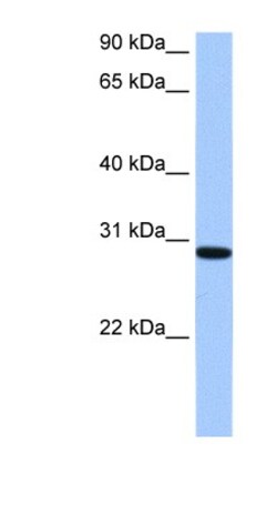 RALYL Antibody, Novus Biologicals 20&mu;L; Unlabeled:Antibodies, Polyclonal