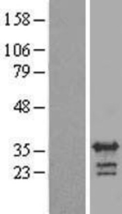 Novus Biologicals&trade;&nbsp;RALYL Overexpression Lysate