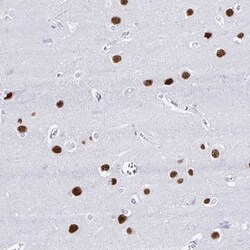 RALYL Antibody, Novus Biologicals 25 &mu;L, Unlabeled:Antibodies, Polyclonal