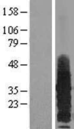 Novus Biologicals&trade;&nbsp;RAMP3 Overexpression Lysate