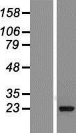 Novus Biologicals™ Ran Overexpression Lysate