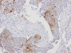 RanBP16 Antibody, Novus Biologicals 0.1mL; Unlabeled:Antibodies, Polyclonal