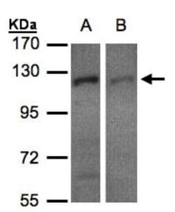 RanBP16 Antibody, Novus Biologicals 0.1mL; Unlabeled:Antibodies, Polyclonal