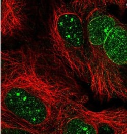 RANBP17 Antibody, Novus Biologicals 25 &mu;L; Unlabeled:Antibodies, Polyclonal