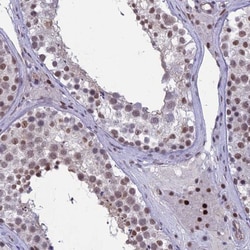 RanBP3 Antibody, Novus Biologicals 0.1mL; Unlabeled:Antibodies, Polyclonal