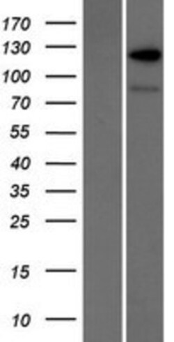 Novus Biologicals&trade;&nbsp;RANBP6 Overexpression Lysate