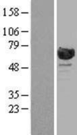 Novus Biologicals&trade;&nbsp;RanGAP1 Overexpression Lysate