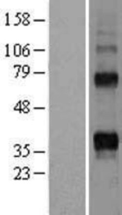 Novus Biologicals&trade;&nbsp;TRANCE/TNFSF11/RANK L Overexpression Lysate